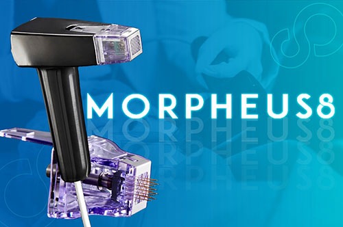 morpheus8 en hermosillo
